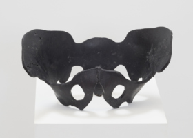 JMP00215_Pelvis_DDH02