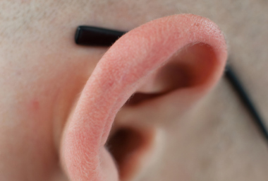 WT00004_Outer Ear_DDM