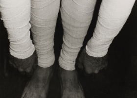 IM00101_Performance with surgical bandage 14