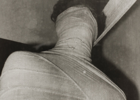 IM00108_Performance with surgical bandage 62