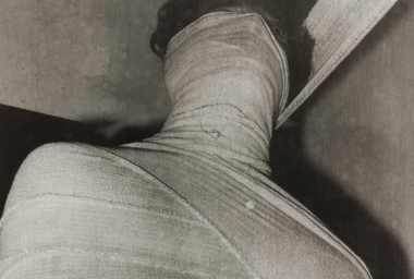 IM00108_Performance with surgical bandage 62