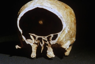 JMP00058_Olho Ciclopico_DDR01.jpg