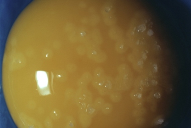 JMP00099_Seasoned Egg_DDH.jpg